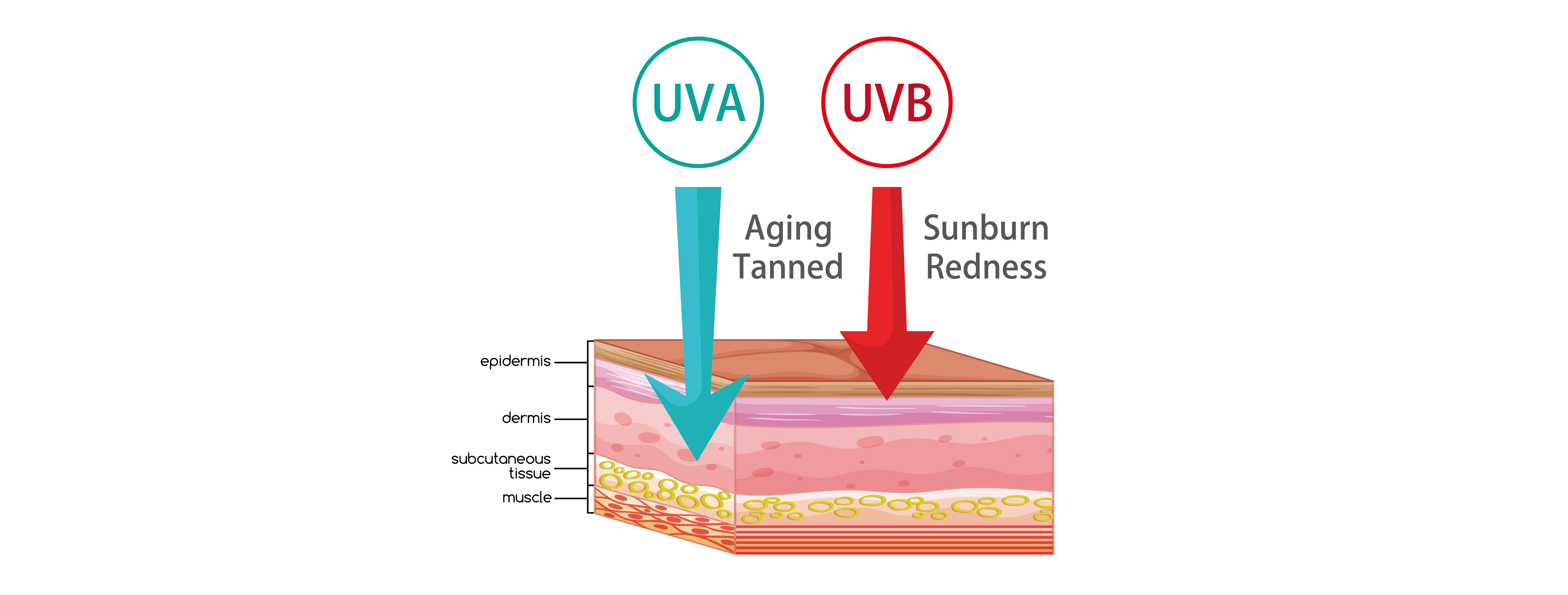 Uva Joint Replacement - tnbto7g
